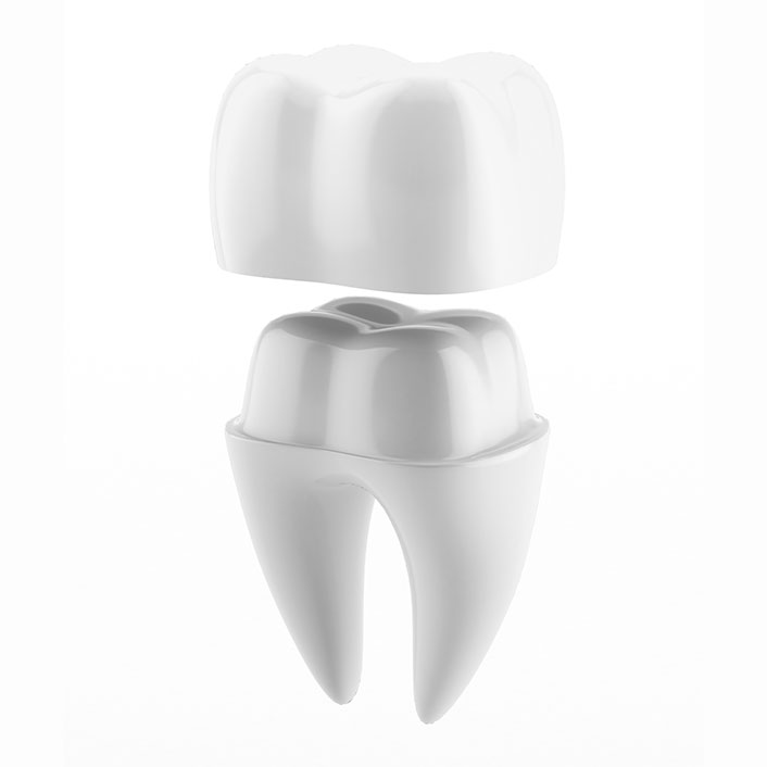 CEREC Same-Day Crowns - Dental Technology